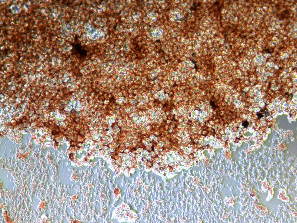 Киборги внутри нас? Модифицированные учеными клетки станут грозной силой в борьбе с опасными заболеваниями Киборги внутри нас? Модифицированные учеными клетки станут грозной силой в борьбе с опасными заболеваниями