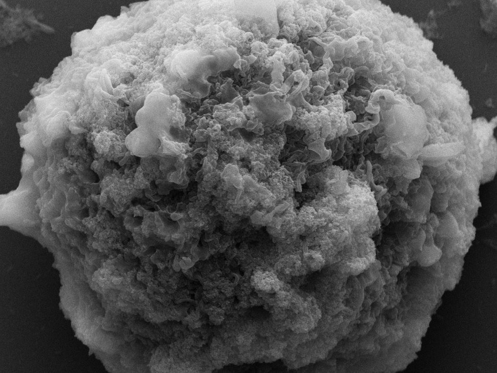 Киборги внутри нас? Модифицированные учеными клетки станут грозной силой в борьбе с опасными заболеваниями Киборги внутри нас? Модифицированные учеными клетки станут грозной силой в борьбе с опасными заболеваниями