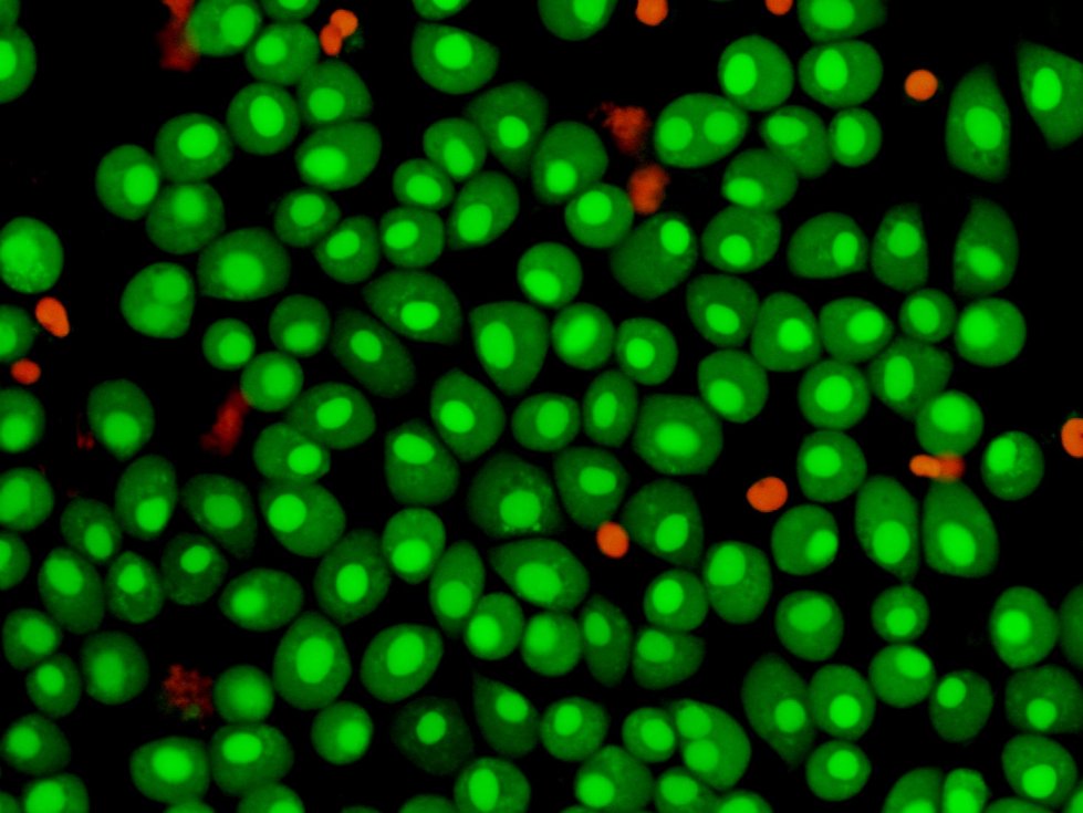 Киборги внутри нас? Модифицированные учеными клетки станут грозной силой в борьбе с опасными заболеваниями Киборги внутри нас? Модифицированные учеными клетки станут грозной силой в борьбе с опасными заболеваниями